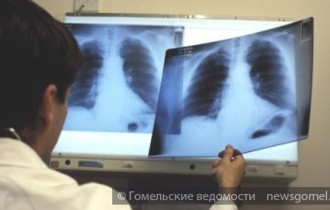 Фото: Сегодня отмечается Всемирный день борьбы с туберкулёзом