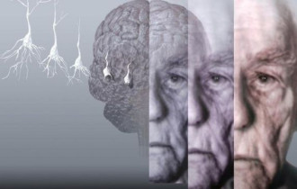 Фото: Врач назвал простой способ снизить риск развития болезни Альцгеймера